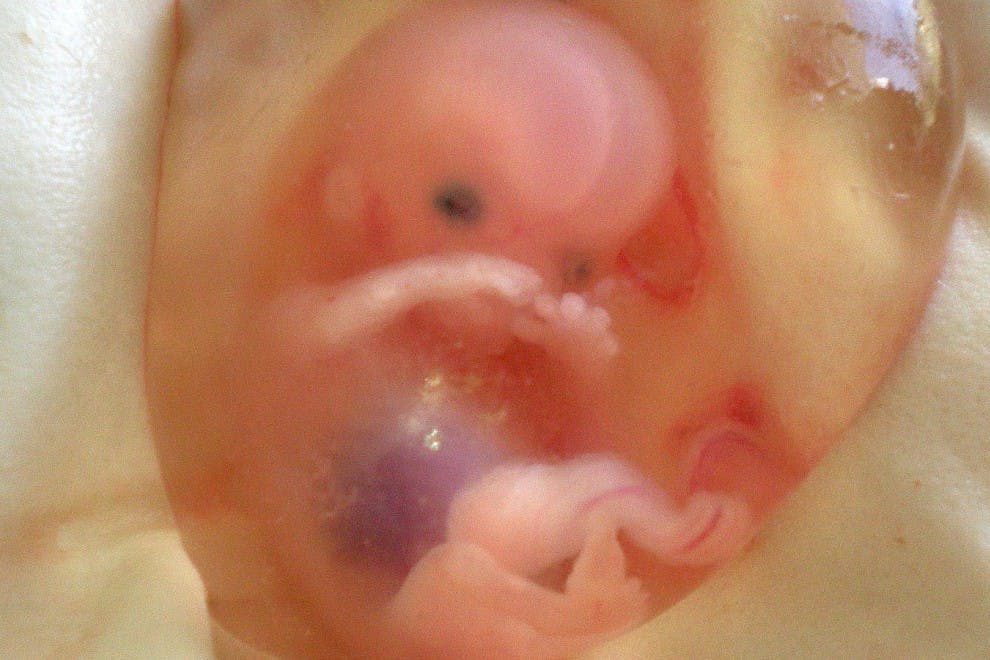 Desde los naturales hasta los inducidos, existen muchas causas tras un aborto.